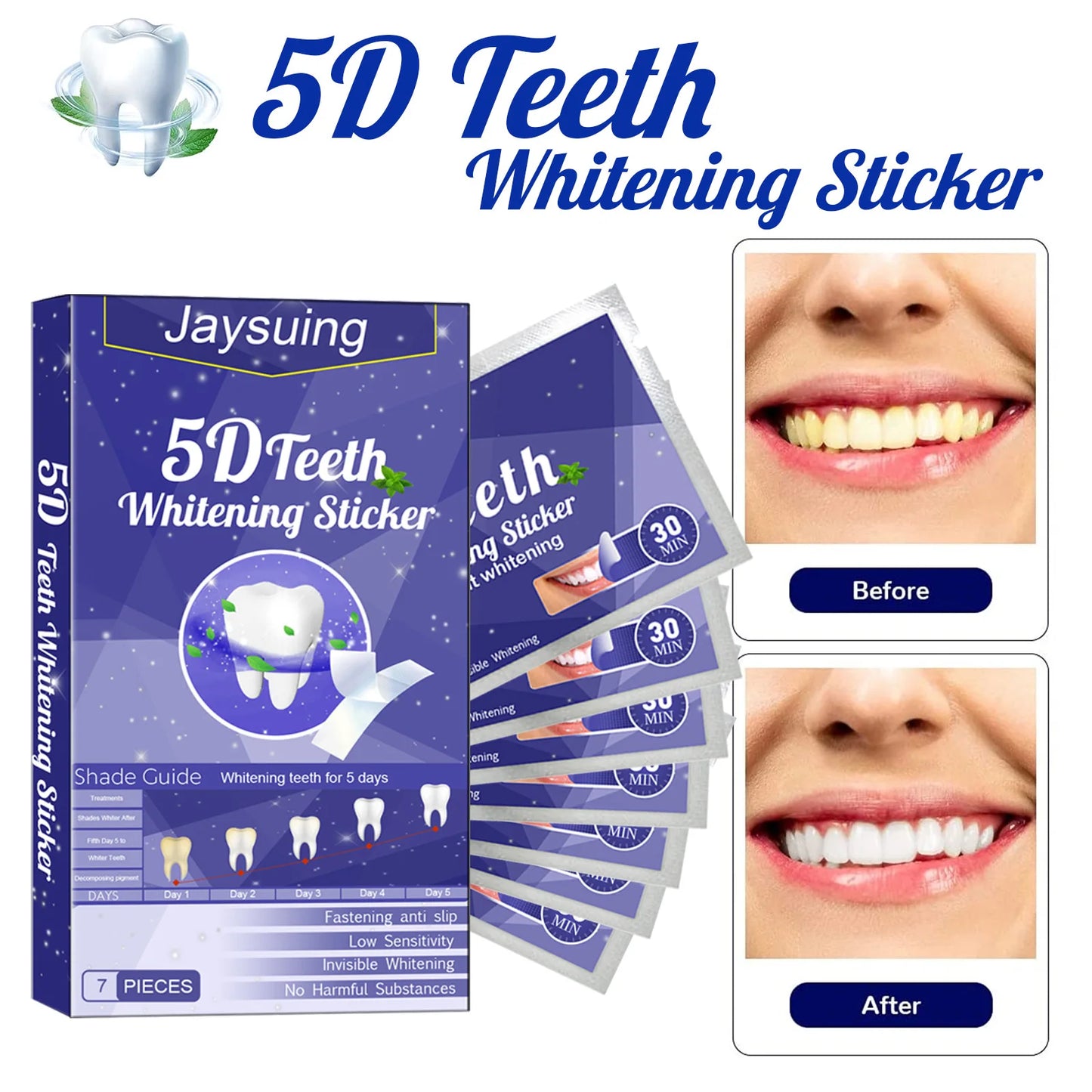 Novalyne Teeth Whitening Kit©