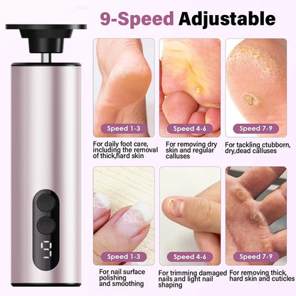 Novalyne Electric Callus Remover©