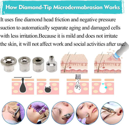 Novalyne Microdermabrasion Machine©