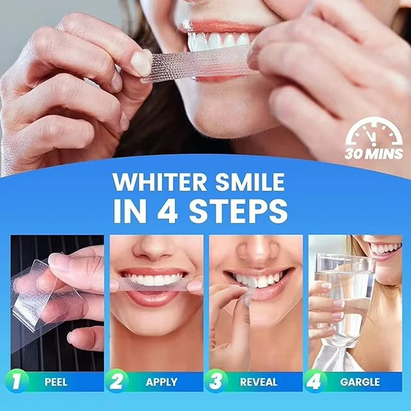 Novalyne Teeth Whitening Kit©